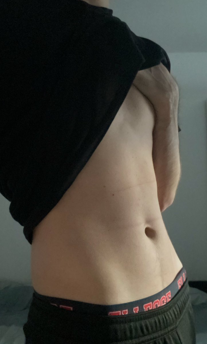 tumballoon4 tweet media