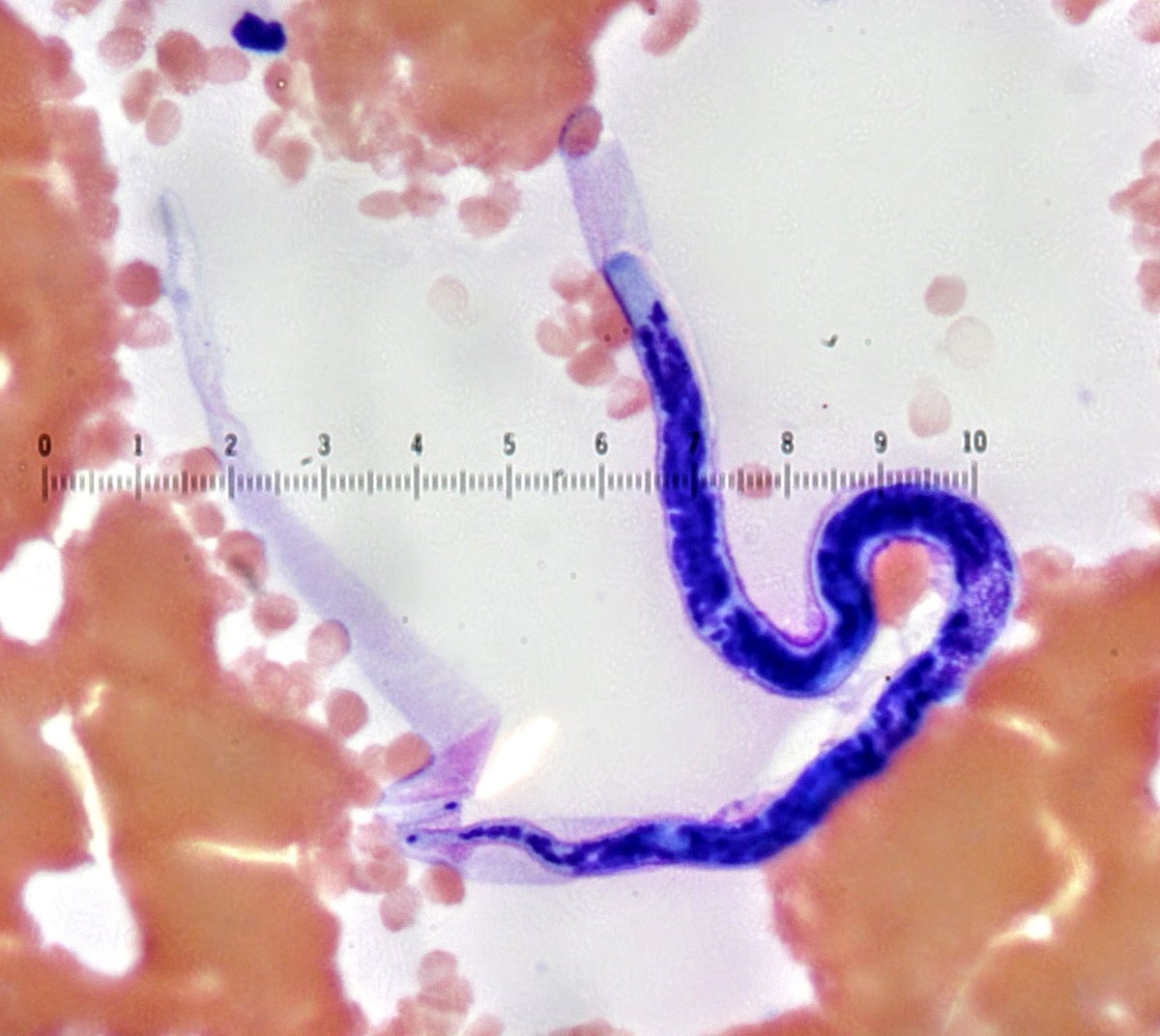 Bobbi Pritt, MD tweet media