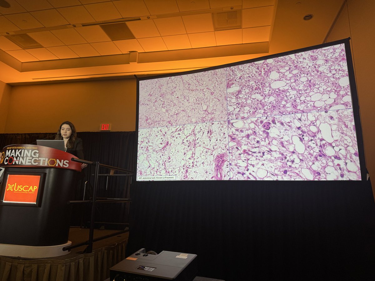 JenniferBoland7's tweet photo. Terrific platform from our @MayoClinicPath resident Ilke Ozcan and her mentor Dr. Andrew Folpe @TheUSCAP https://t.co/gWWmA26TRE