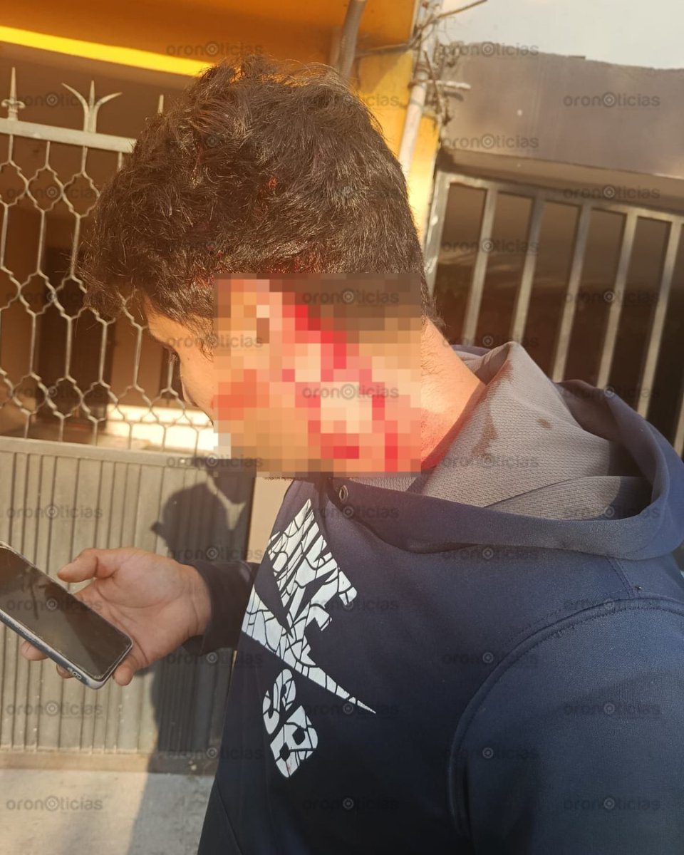 OroNoticiasPue's tweet photo. #Seguridad 🪨 Personas resultaron lesionadas por las rocas que aventaron los supuestos carteristas de una unidad de la Ruta 41, en Amalucan. https://t.co/iovqzfMMf0