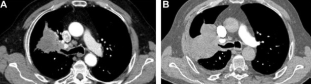 JTO & JTO CRR tweet media