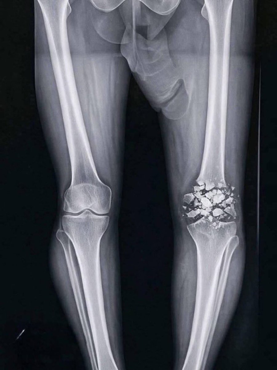 𝙈𝘽𝙏🍀 tweet media