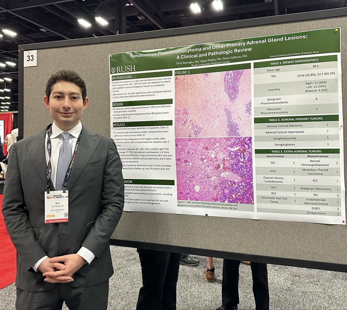 Onur Ibanoglu tweet media