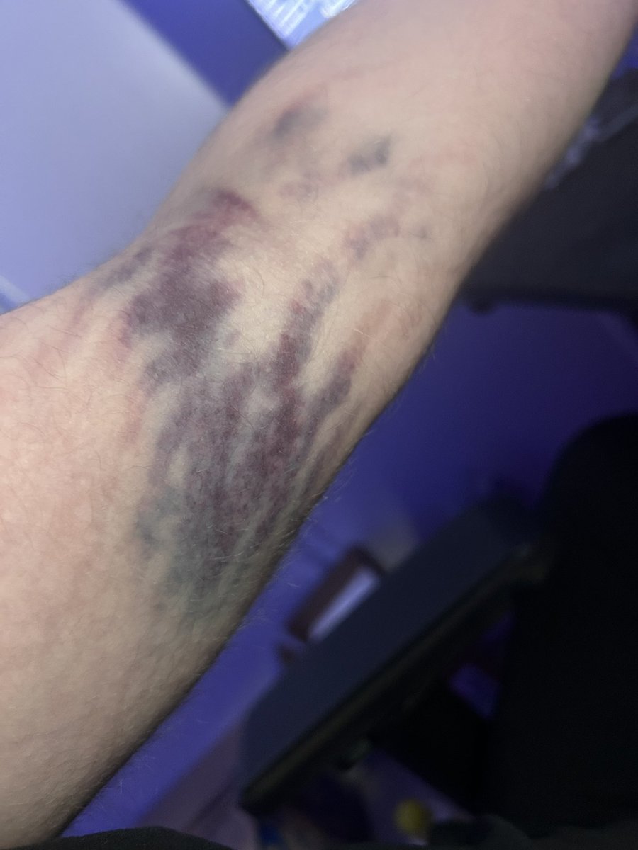 Merrychoupi 🦝 tweet media