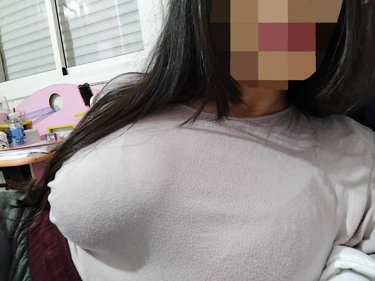 FatTomie // temporary recovery tweet media