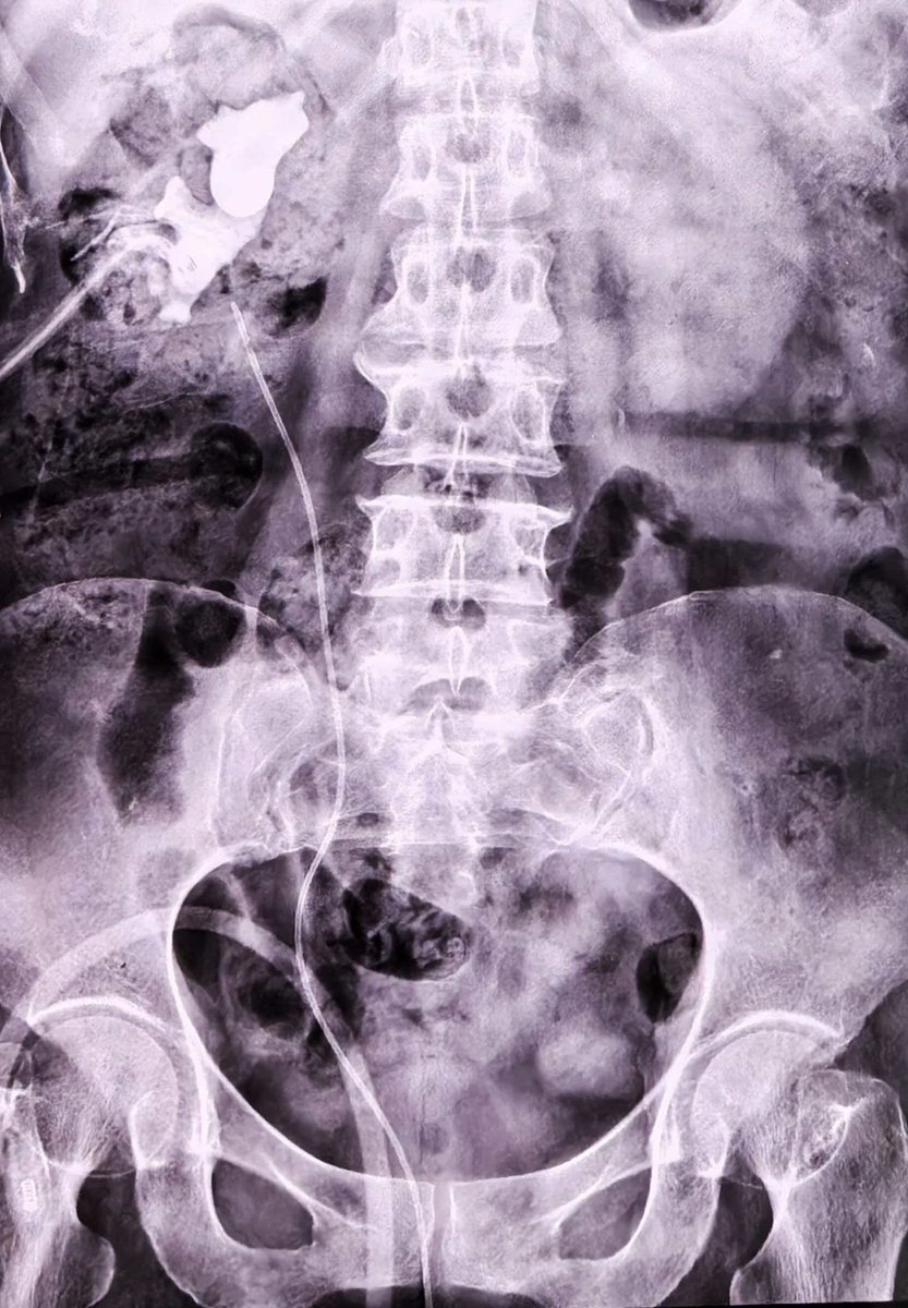 Yang Kunlin tweet media