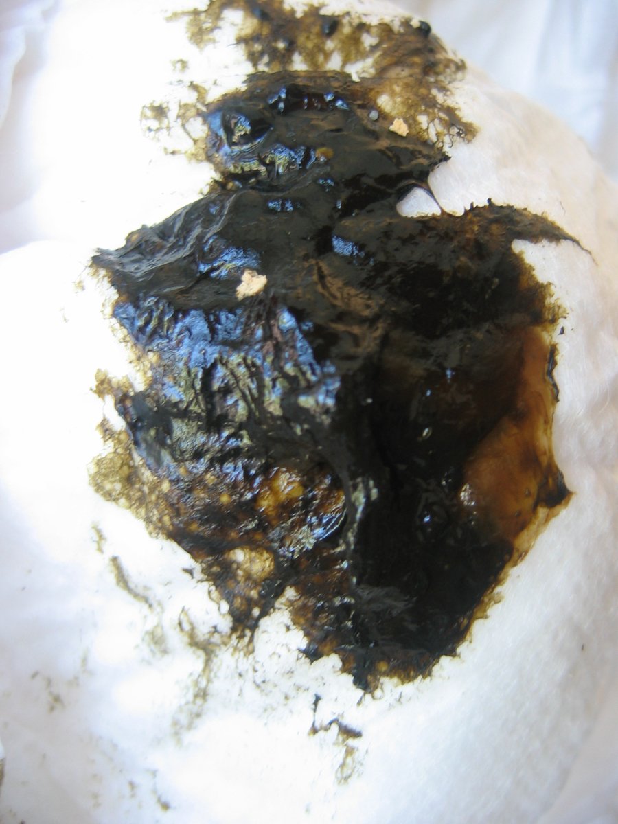 Dr Abdul Hameed 🩺 tweet media