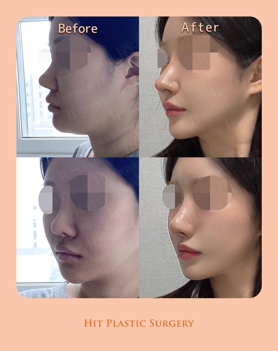 ヒット整形外科 tweet media