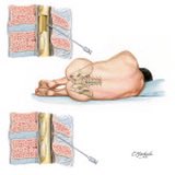 Sanjay S. Dhall, M.D. tweet media