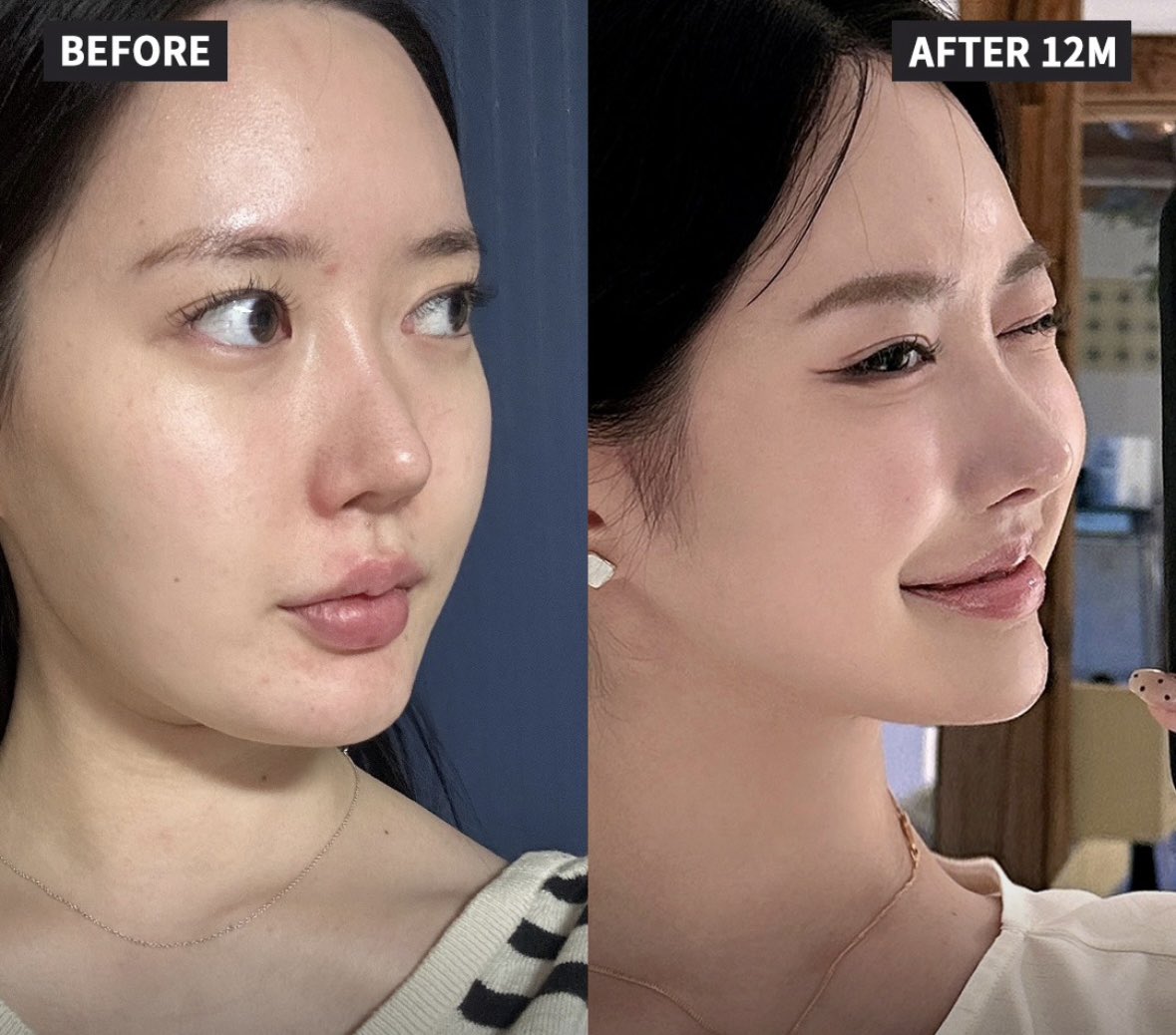 JT整形外科(輪郭・鼻・目専門) tweet media