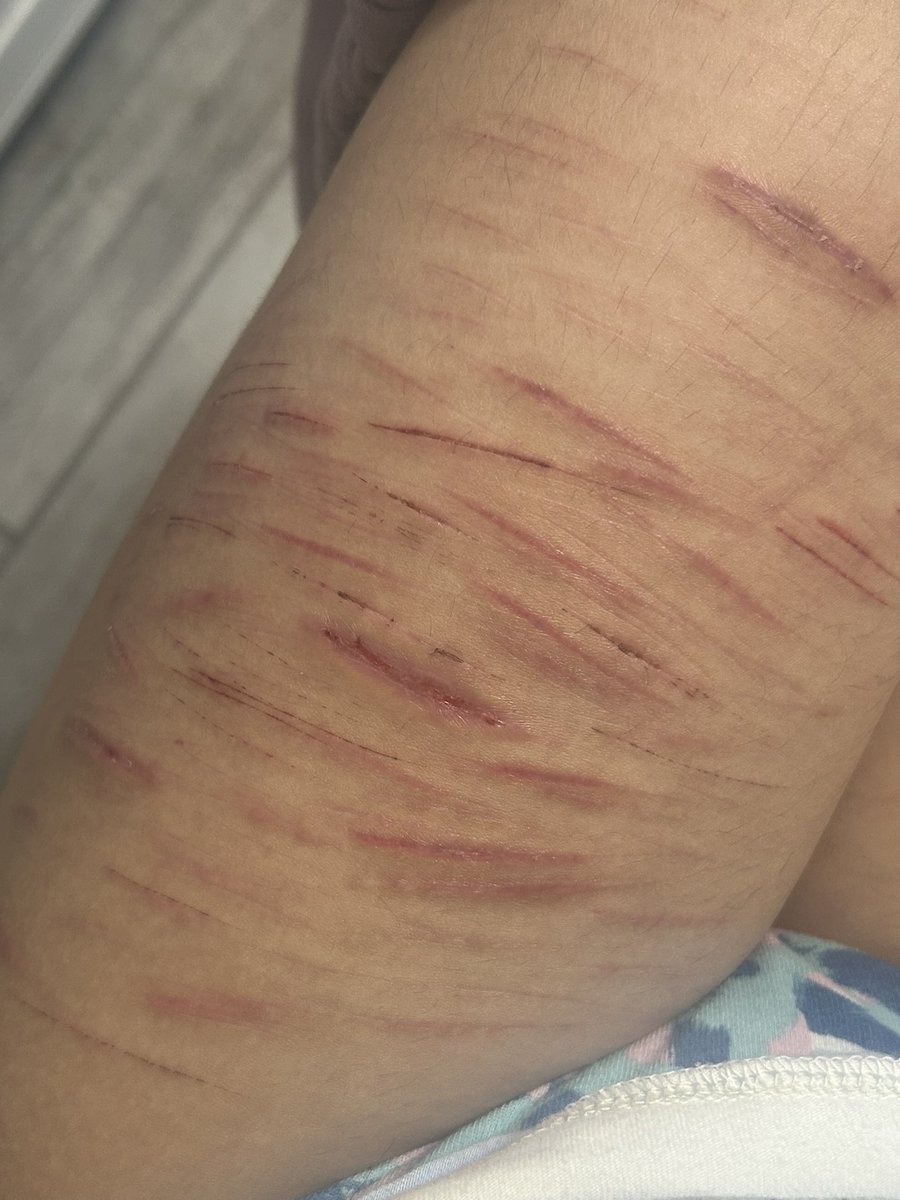 ﹒ ʚ g a n g l e o f s h t w t ɞ ﹒ tweet media