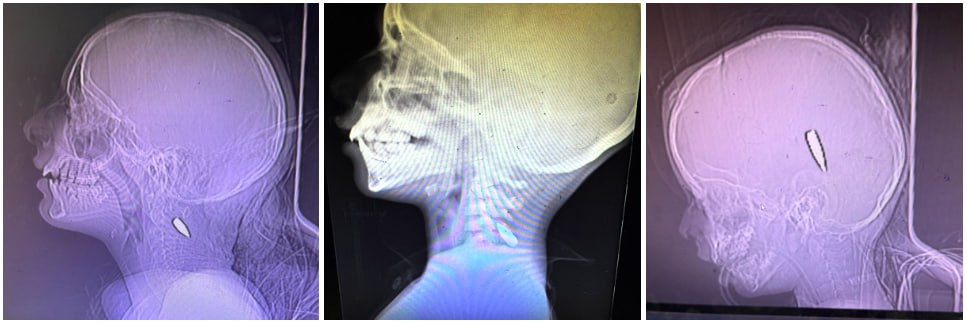 horschamp tweet media