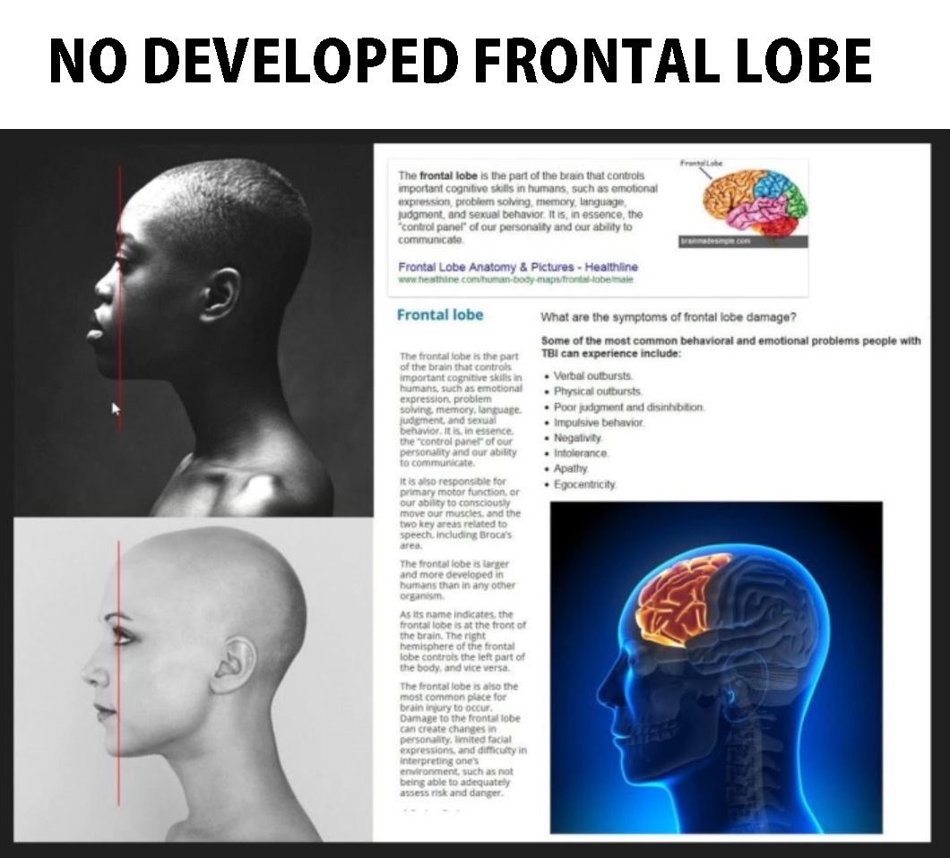 BillyBongJung tweet media