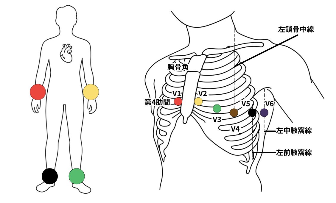 心電図くま | ECG KUMA tweet media
