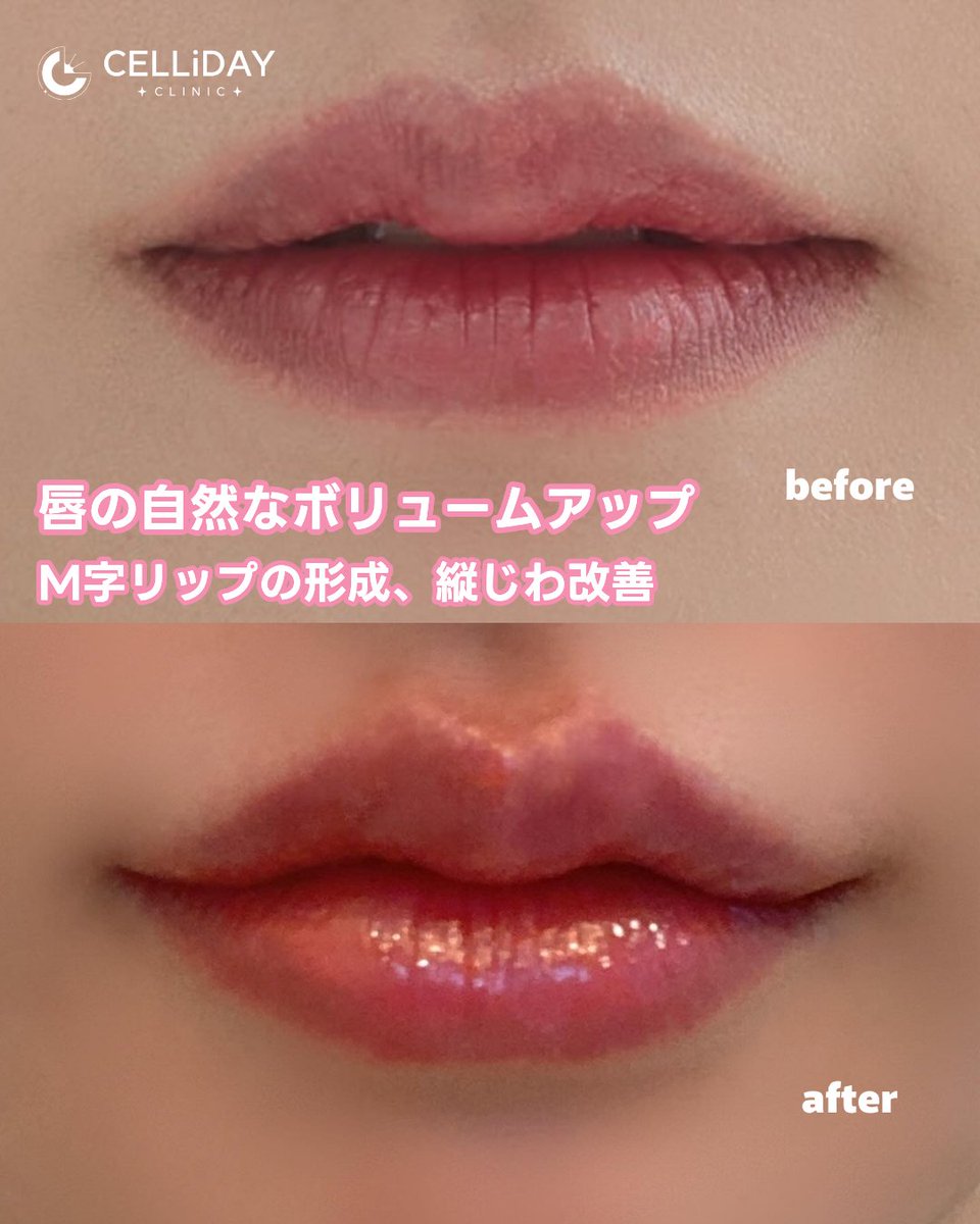 セリディクリニック江南店・CELLiDAY CLINIC・ tweet media