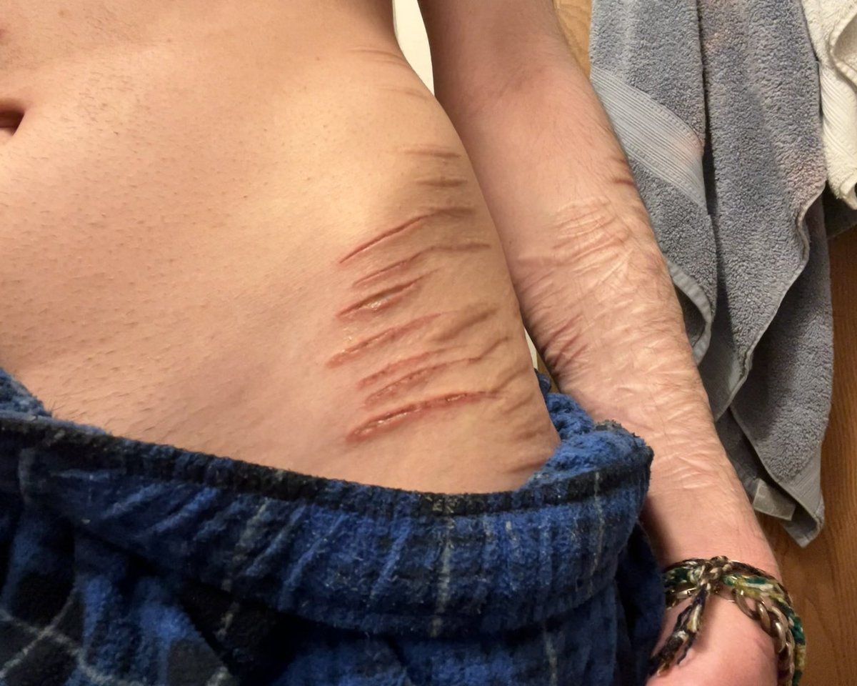 ca1wb 🍃 shedtwt tweet media