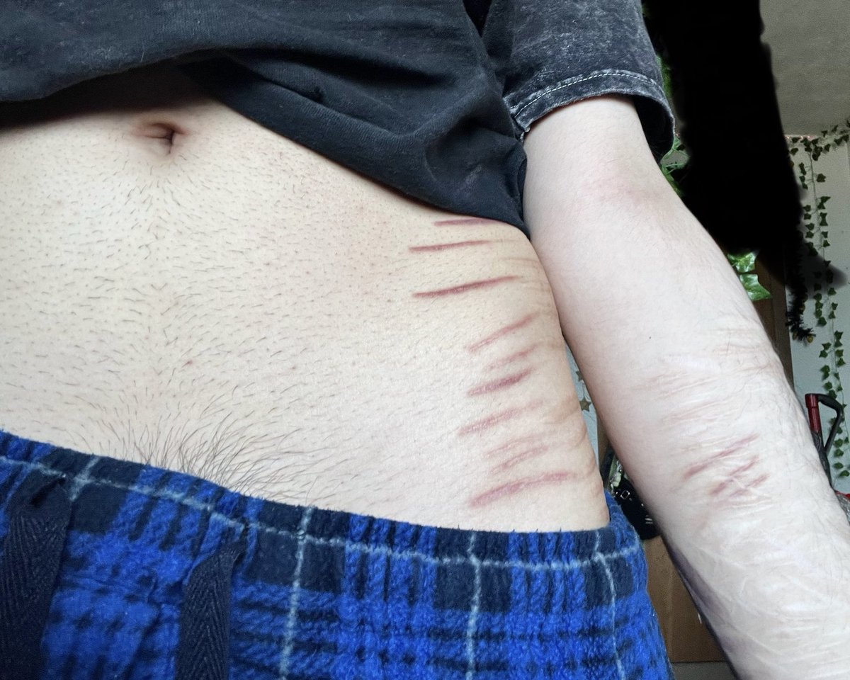 ca1wb 🍃 shedtwt tweet media