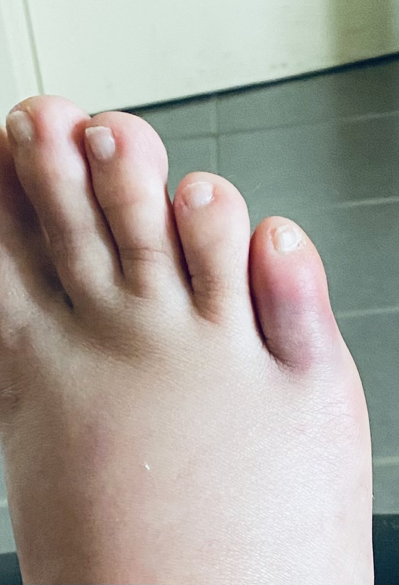 Charlie Bucket tweet media