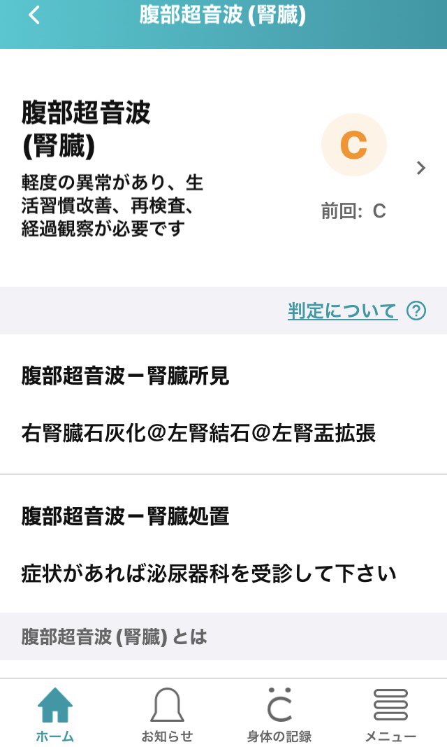 インプレッサakito tweet media