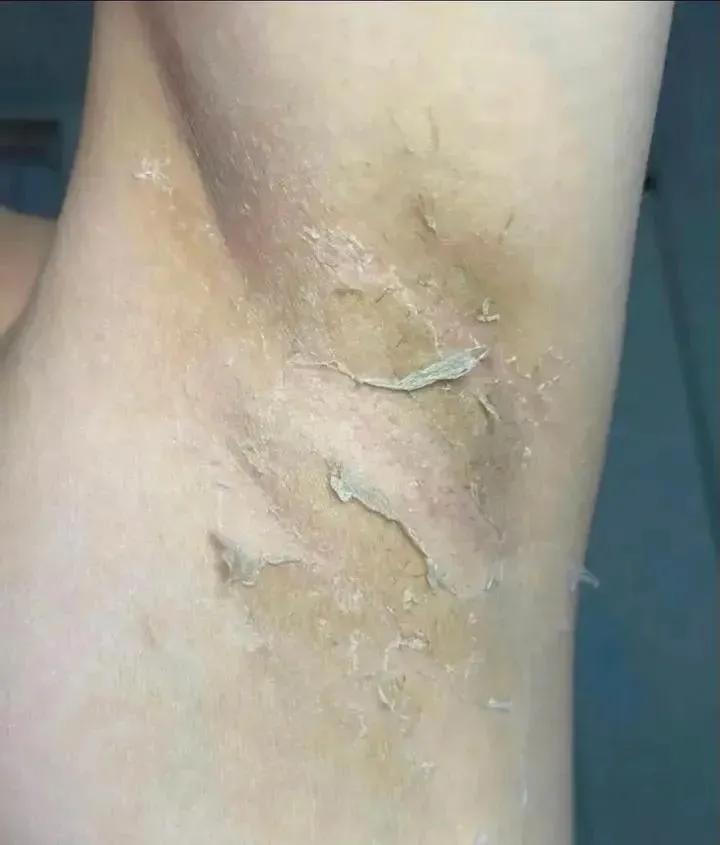 spill here tweet media