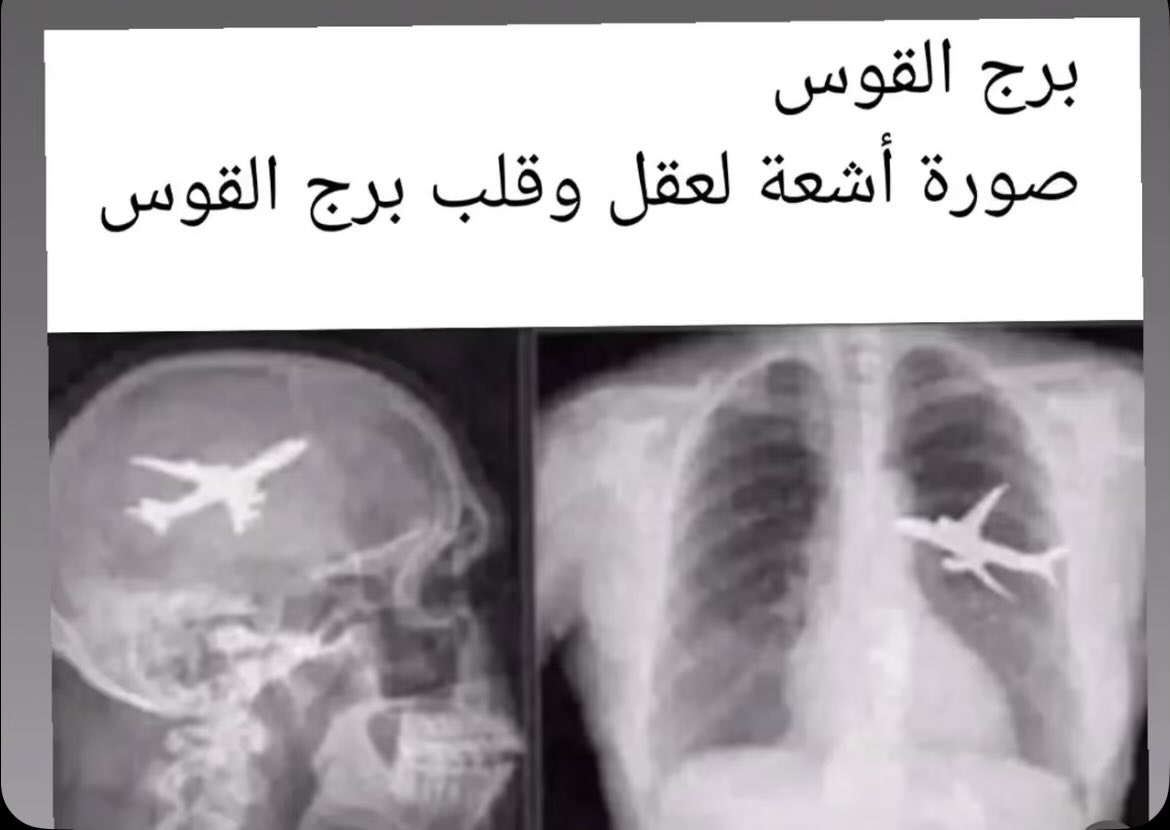 HUDA🐎 tweet media