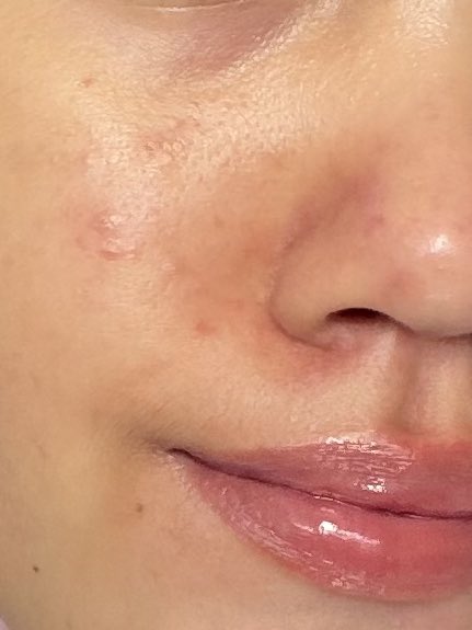 irapersa's tweet photo. goodbye redness &amp; dry skin, hello hydrated &amp; healthy skin👋🏻

cocok buat kaum mageran, soalnya cuma pake satu produk https://t.co/zLWd6GPTod