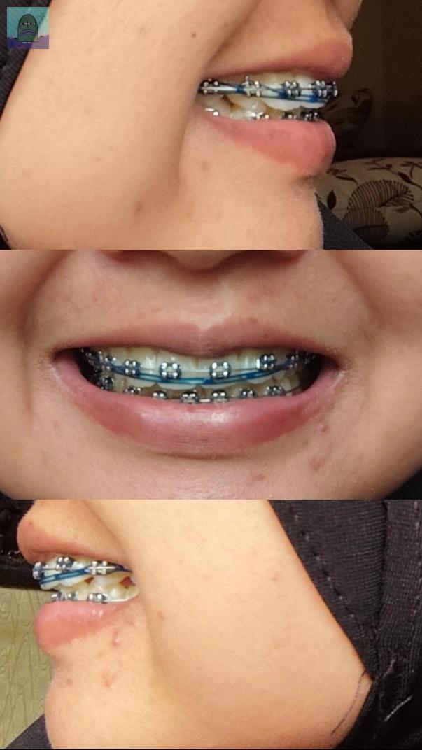 Tanyarl 💚 tweet media