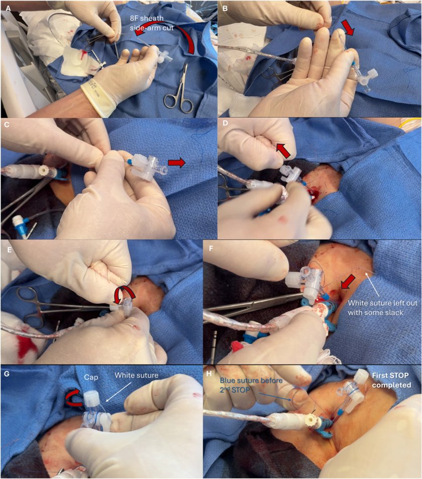 Giuseppe Biondi-Zoccai tweet media