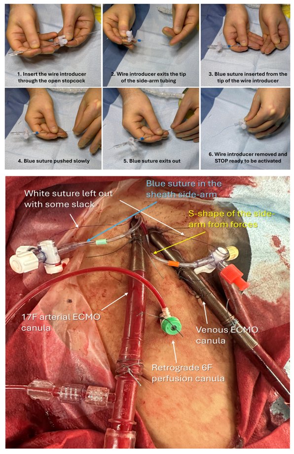 Giuseppe Biondi-Zoccai tweet media