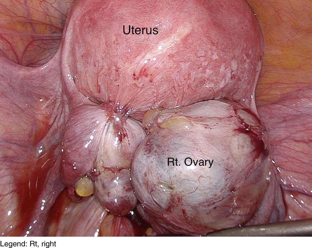 Bellah🦩 tweet media