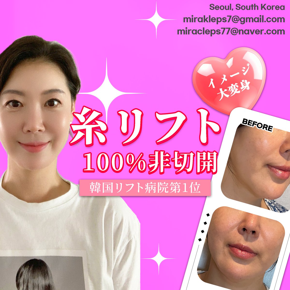 miraclelifting's tweet photo. 狎鴎亭ミラクル医院
🩷Instagram🩷 : https://t.co/L7MQurokdL
💚 Line ID 💚:@miracleps_japan
🔹E-MAIL🔹: mirakleps@gmail.com
糸リフトの NO1! ついに日本本土上陸間近！
👉シワ、たるみ まだお悩みですか？
👉韓国糸リフト、第1位の病院
👉100%非切開、10分施術で10年若返り
👉メスを使わず、たった10分で、10年若返り
👉驚くほどスッキリシャープなフェイスライン
👉糸リフトたった1つのみ施術する糸リフト専門病院
👉米国FOX TV NEWSより認証された世界TOPリフティング
👉最新非切開リフティング開発者認証
👉日本最大美容整形シロモトクリニックもDR.WOOリフティングを伝授してもらう
👉施術当日直���、旅行や食事可能など日常復帰可能！
👉世界の有名なDOCTORたちもウ·ジョンホ院長に技術を伝授してもらう
👉ハリウッド俳優多数施術
👉カナダQUILL整形室 諮問医師

#糸リフト#韓国糸リフト#韓国美容 #韓国整形  #ジョールファット除去