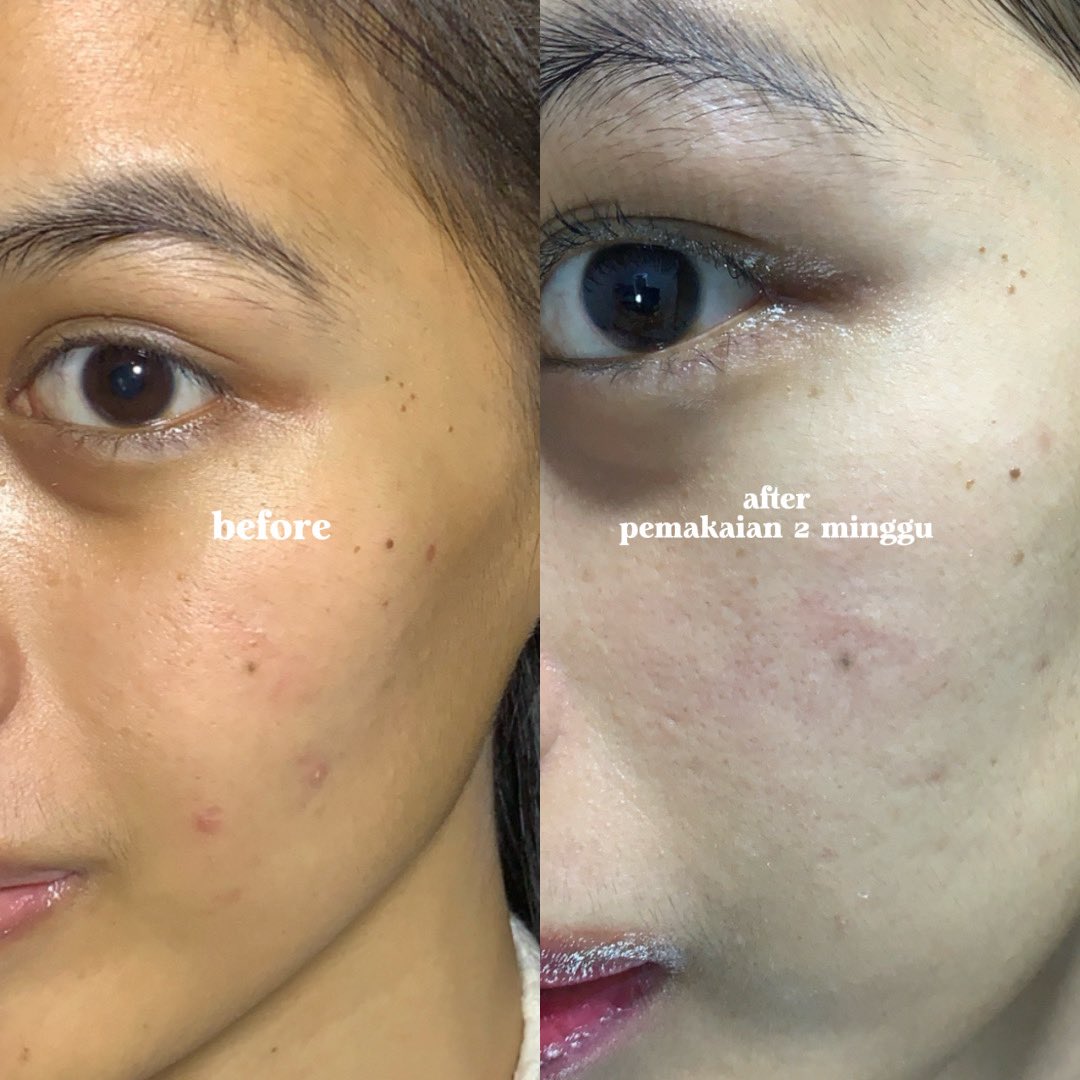 fiiardini (◕ᴗ◕✿) tweet media