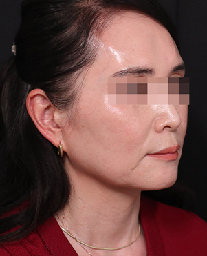 【公式】リバースクリニック | 江南・明洞・弘大 tweet media