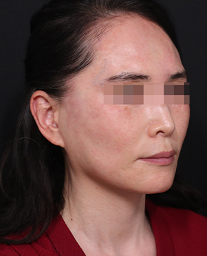 【公式】リバースクリニック | 江南・明洞・弘大 tweet media