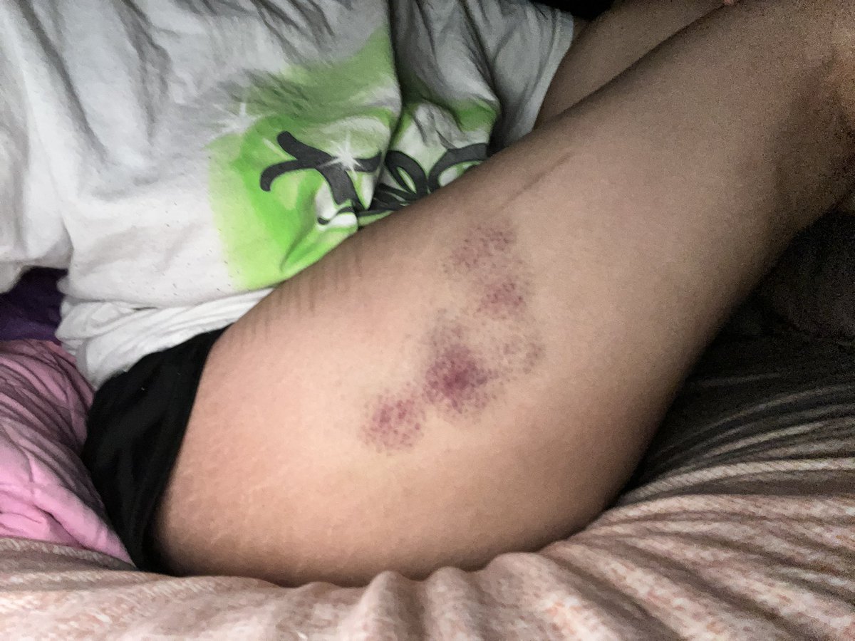 Spirit Albarn of shtwt 🚬 tweet media