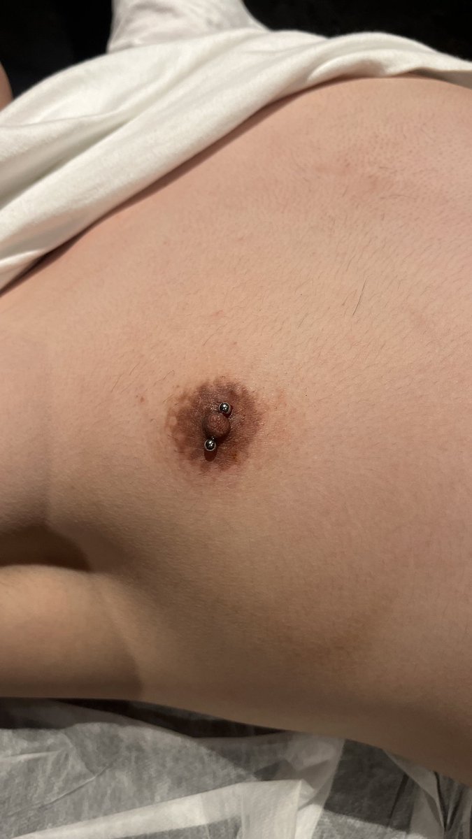 南京男士脱毛.鸡吧增粗.穿孔.入珠.私密纹身 tweet media