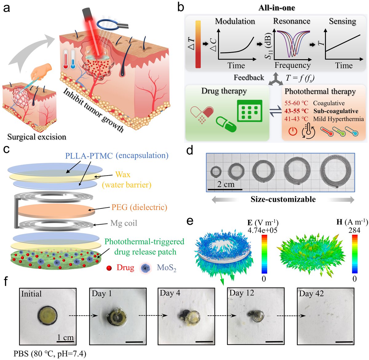 iLZU1909's tweet photo. #LZU has made significant progress in developing a bioresorbable inductive-capacitive sensor system for preventing postoperative tumor recurrence. This breakthrough, published in Advanced Materials, combines wireless temperature monitoring, photothermal therapy, and on-demand drug release into a single, implantable device. The system, designed to be implanted after tumor resection, degrades naturally in the body after completing its therapeutic task. #LZUResearch
🔗Discover more: https://t.co/jMhyd7SvXw