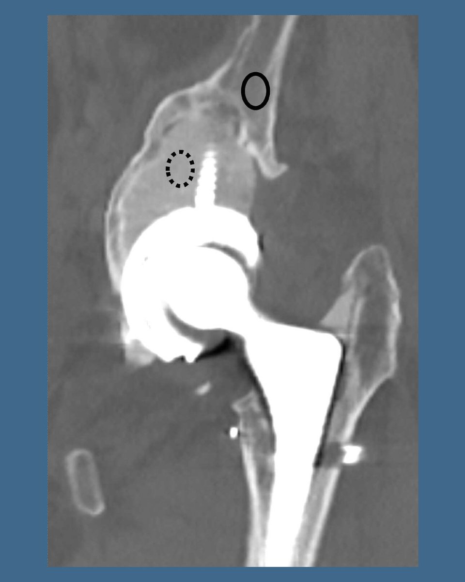 Bone & Joint Open tweet media