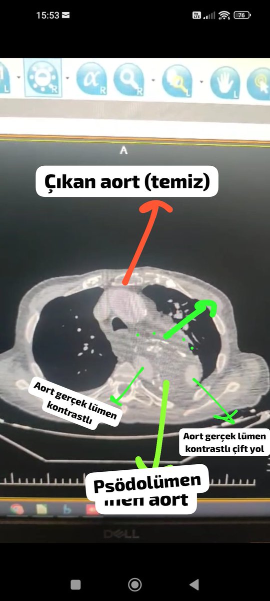 Sıtkı Sarper Sağlam tweet media