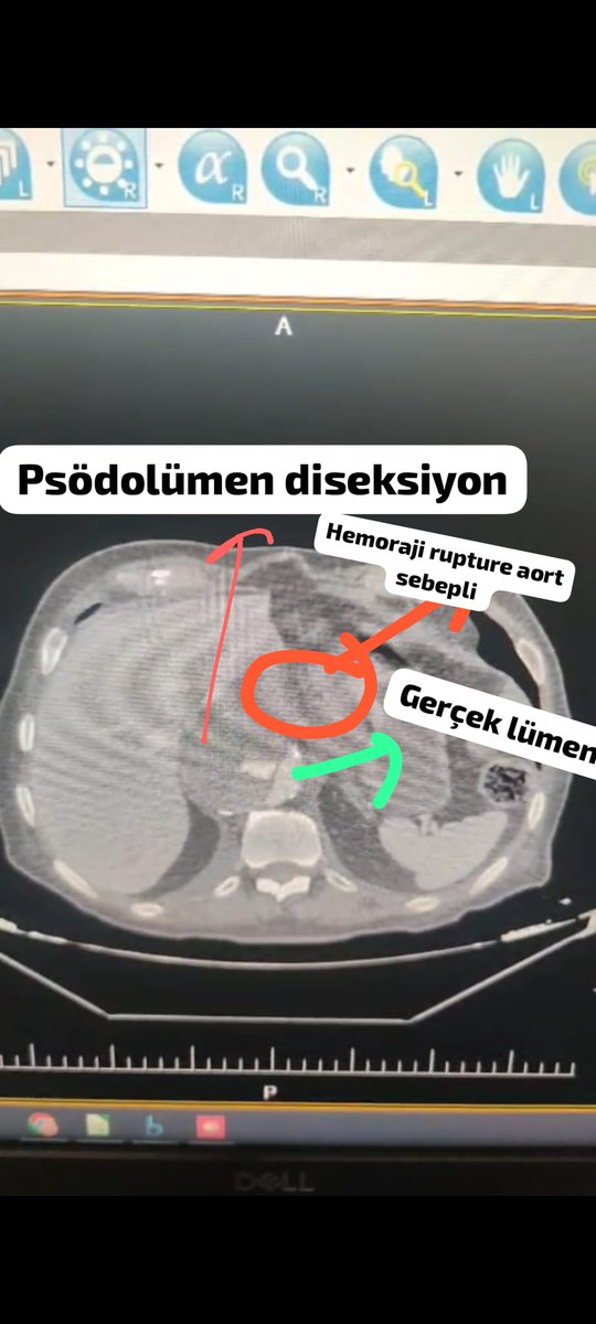 Sıtkı Sarper Sağlam tweet media