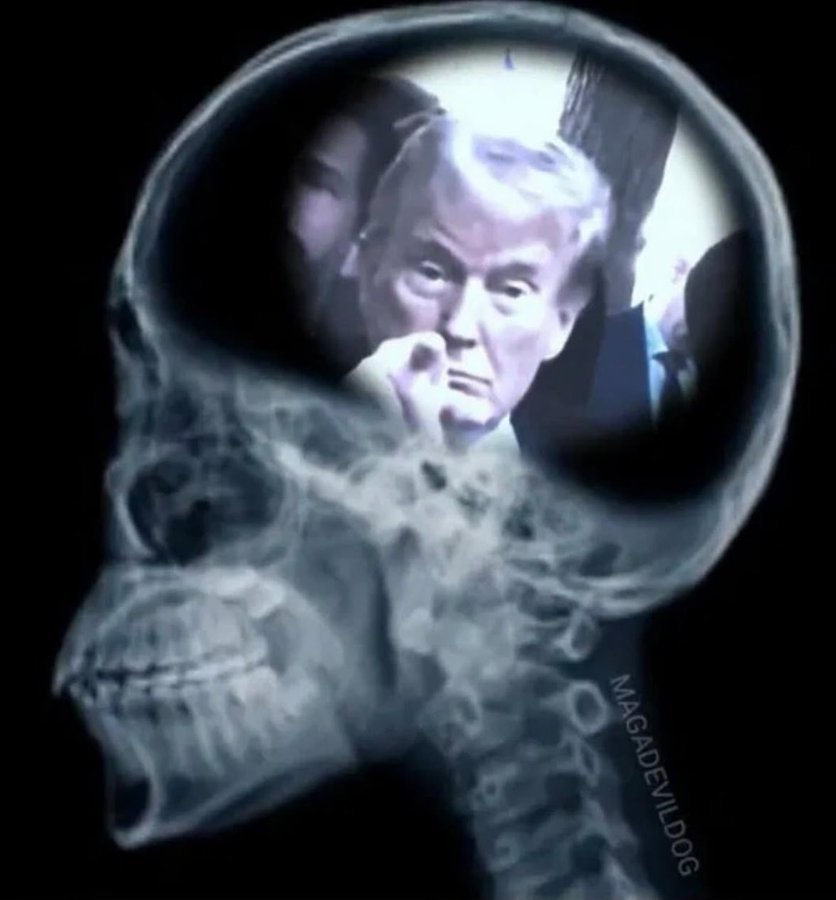 harry lazard tweet media