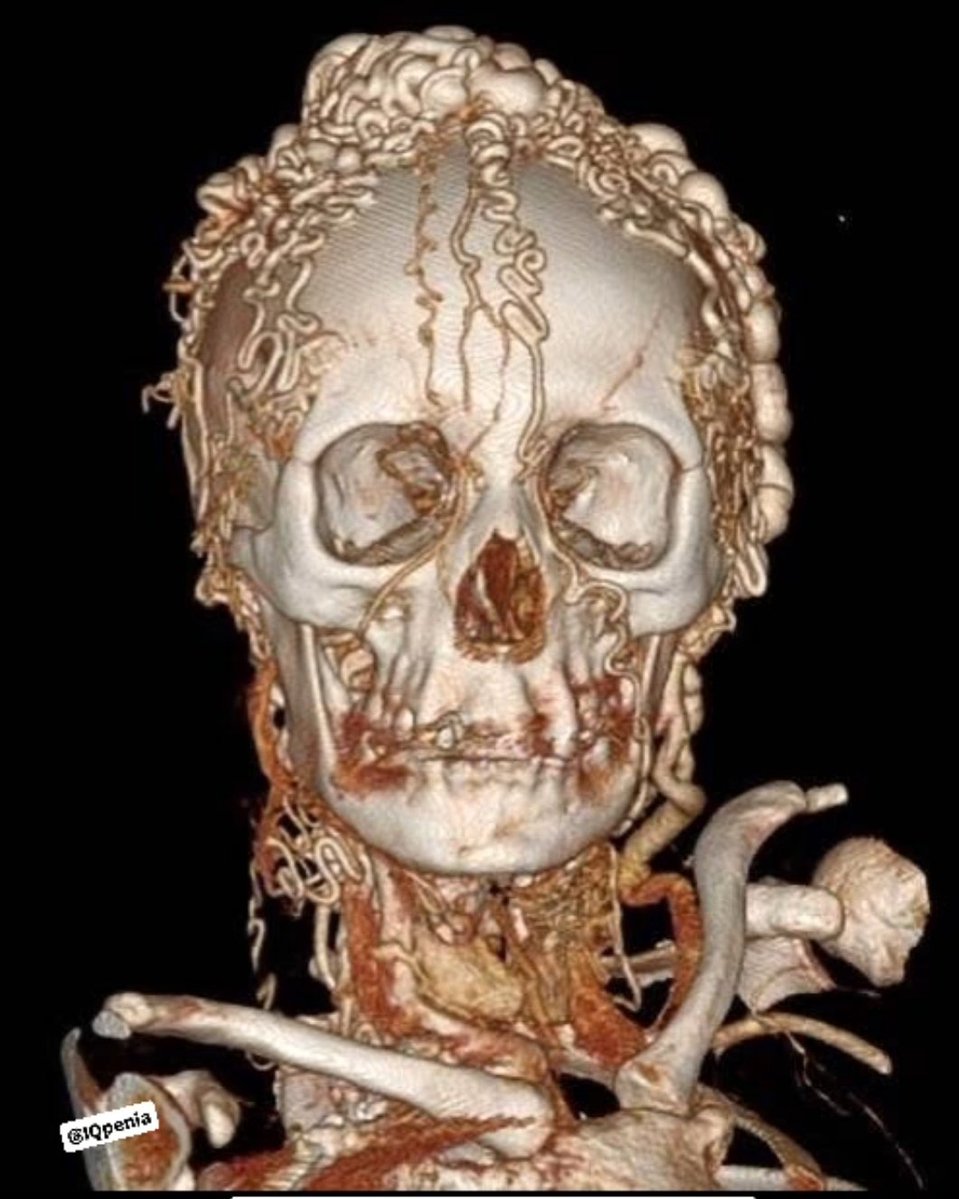 Dr Abdul Hameed 🩺 tweet media