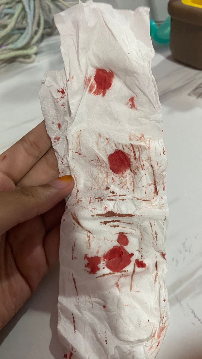 yuxiyue_'s tweet image. hi this is my tissue, like if you love my tissue
TW: blood, stinky blood
#shtwt #blood #tissue #selfharms #accident
