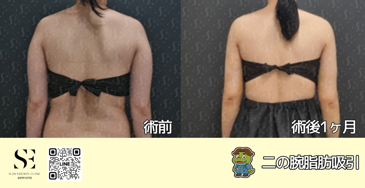 スリムエディション医院 tweet media