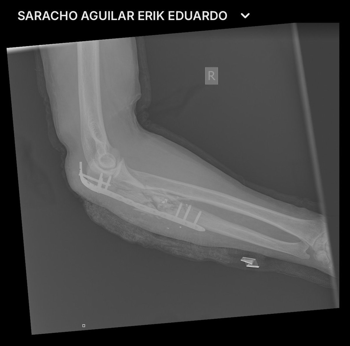 Erik E. Saracho Aguilar tweet media