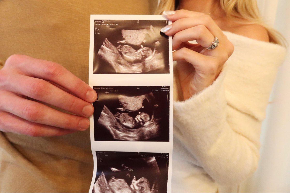 Micah Potter tweet media