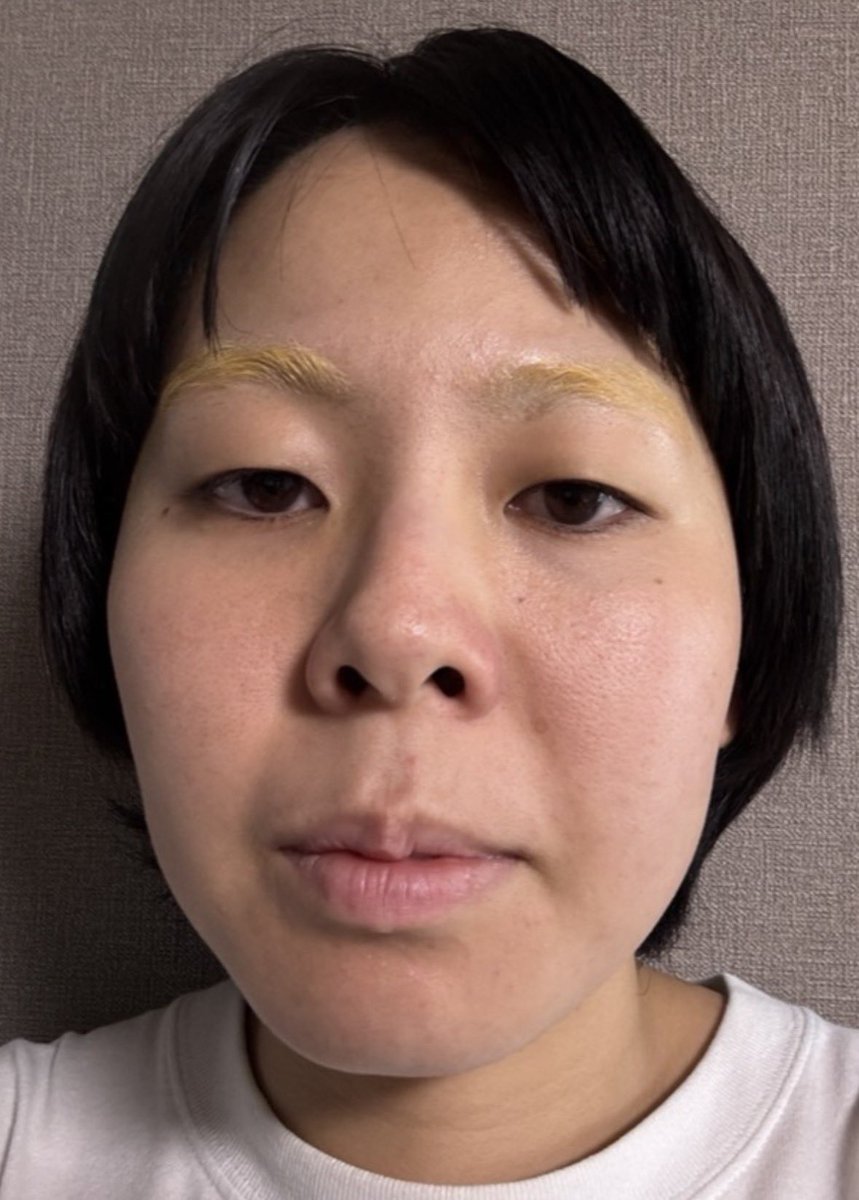 yonedamakoto526's tweet photo. 27歳になりました
写真は去年の今日のものです
来年の今日に
今日の写真を載せると思います

載せなかったらごめん
ありがとう https://t.co/fZp6UD8odm
