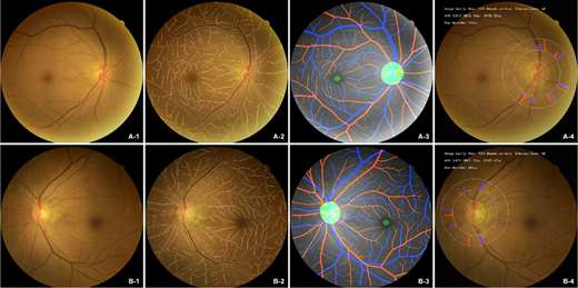 TVST Journal tweet media