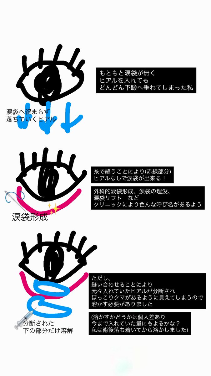 SALLY💊薬剤師♡美容 tweet media