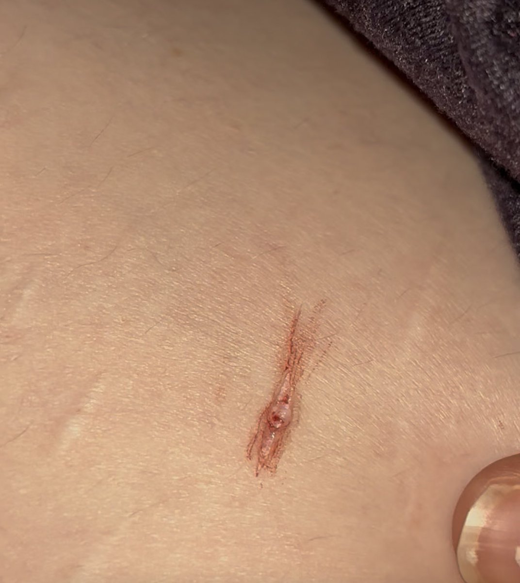 finnie !! tweet media